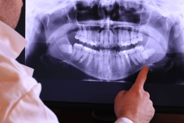 Best Weekend Emergency Dentist in Bensenvle, IL