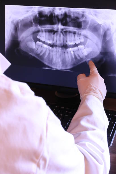 Best Emergency Dental Care for Broken or Chipped Teeth in Bensenvle, IL