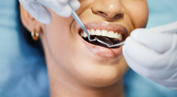 Best Cosmetic Emergency Dentistry in Bensenvle, IL