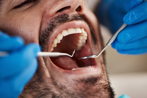Best Emergency Dental Care for Broken or Chipped Teeth in Bensenvle, IL