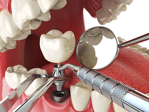 Best Weekend Emergency Dentist in Bensenvle, IL